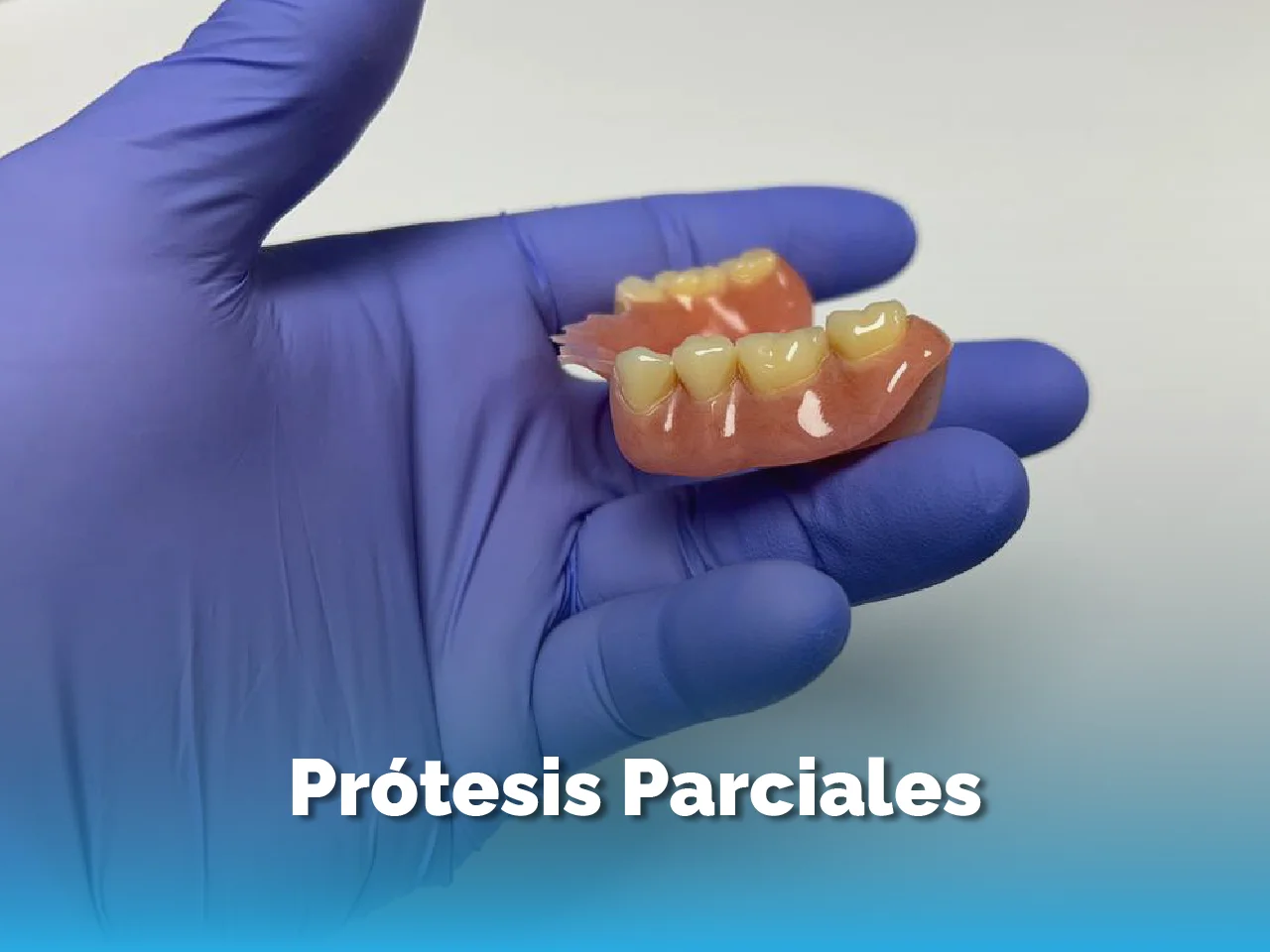 Prótesis Parcial - Top Dental