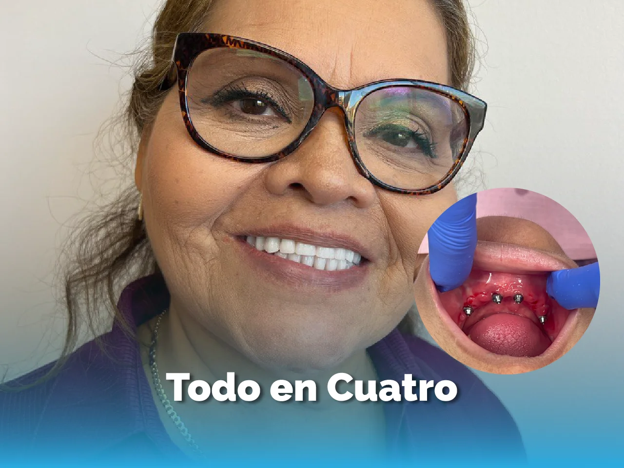 Todo en Cuatro - Top Dental