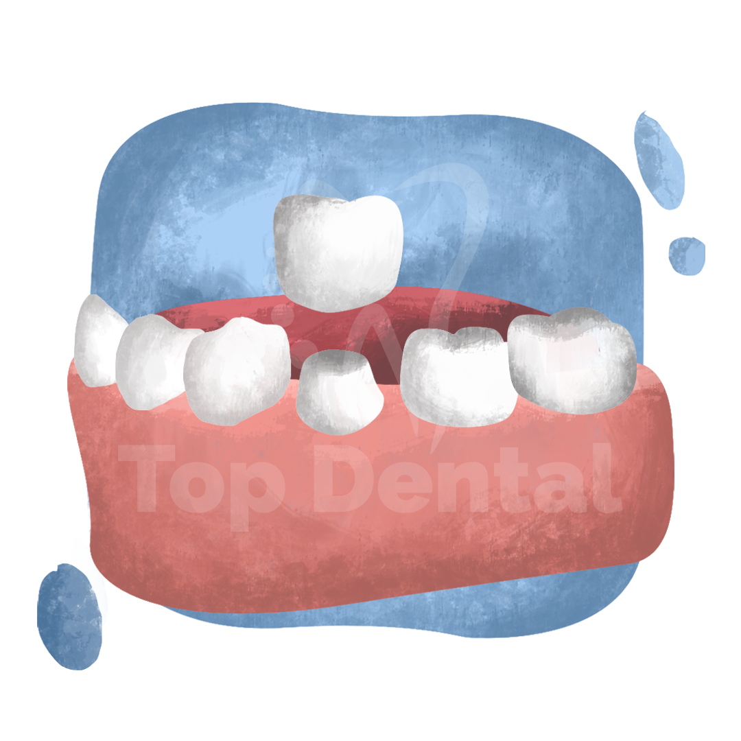 endodoncia