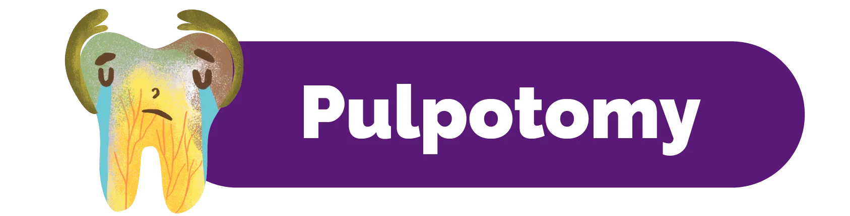 Pulpotomy